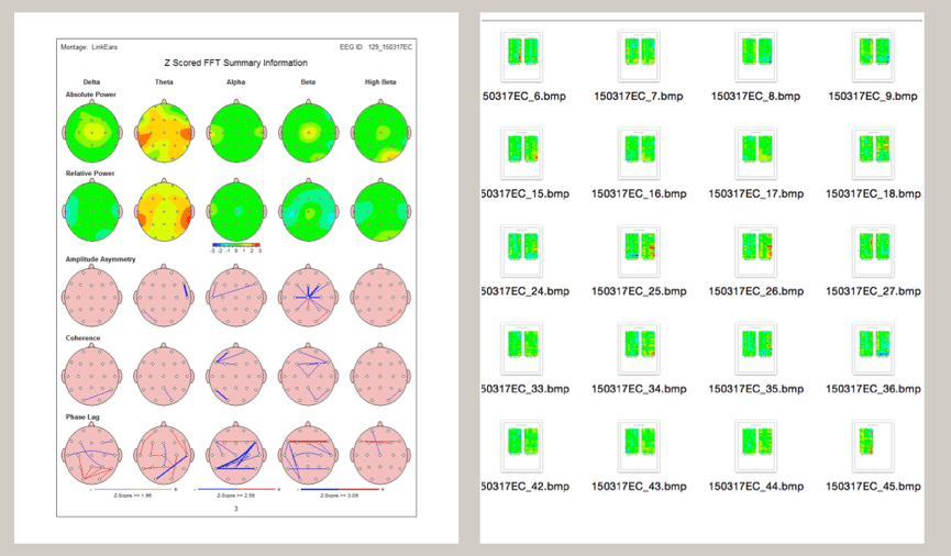 ECmaps